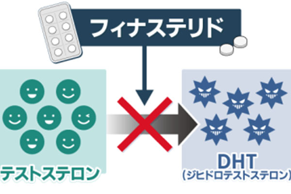 フィナステリドの副作用|症状や対処方法について解説