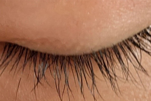 ミノキシジルでまつ毛は伸びるのか?外用薬と内服薬別の影響について