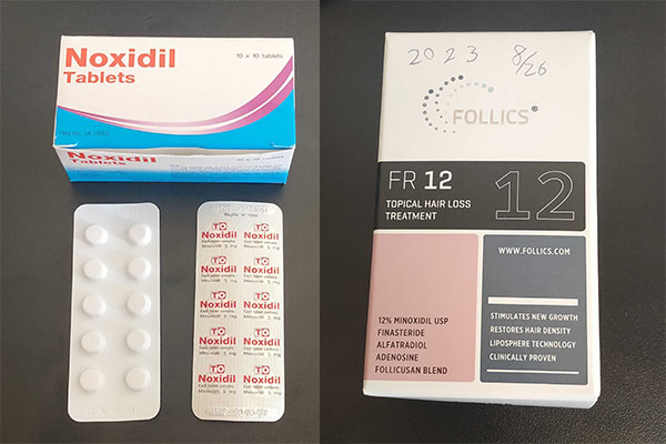 ミノキシジルジェネリック徹底比較|内服薬・外用薬の選び方